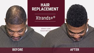 Full Head of Hair FAST | Xtrands+ Hair Replacement System