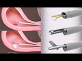 Operative hysteroscopy for polyps and fibroids | TVASurg