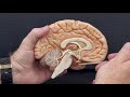 Professor Long 2401 Lab Internal Brain Anatomy