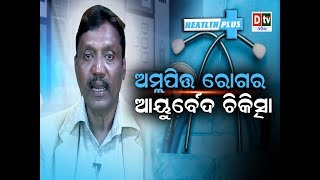 Hyper Acidity | ଅମ୍ଳପିତ୍ତ ରୋଗ ର ଆୟୁର୍ବେଦ ଚିକିତ୍ସା