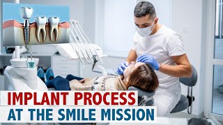 Implant Process at The Smile Mission