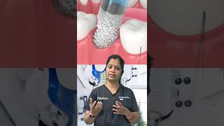 Implant+முழு Fixed பல்செட் மருத்துவரிடம் 7கேள்விகள் எலும்பு குறைவாகஇருந்தால் எந்த முறை உபயோகிப்பிங்க