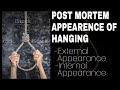 postmortem Appearance of Hanging || External appearance || ligature marks || Part - 1