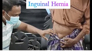 Inguinal Hernia || surgery short case || surgery