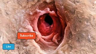 Amazing Electron Microscope Images