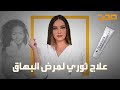 العربية صحة | علاج ثوري لمرض البهاق