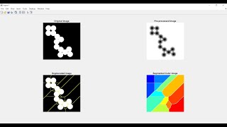 Segmentation using Watershed Algorithm in Matlab | Practice Problem
