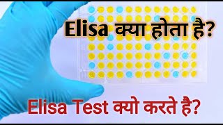 Elisa test | what is elisa in hindi