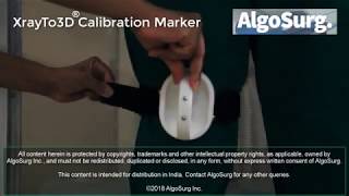 Convert simple X-rays into 3D bone model using XrayTo3D Calibration Marker - (www.tabplan3d.com)