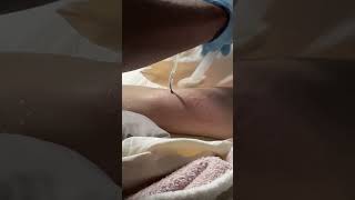 Dianna shows us her PICC line
