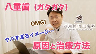 八重歯・ガタガタ歯（叢生） 原因と矯正治療方法　大阪の矯正歯科　淀屋橋矯正歯科