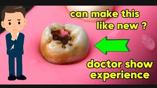 root canal treatment