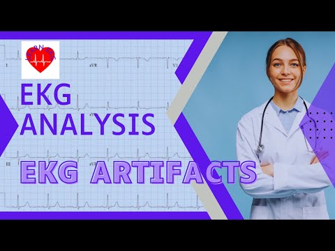 What are the types of ECG artifact?