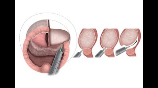 EAU 2022 8-minute video with drawings