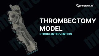 Mastering the Thrombectomy Model Connection | SurgeonsLab IFU Tutorial