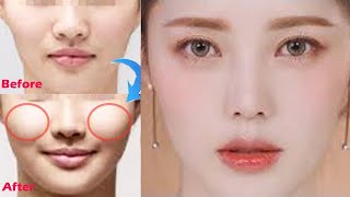 How To Get Chubby Cheeks Fast | បំបាត់ថ្ពាល់ផតនិងមុខពេញតឹងណែនស្អាត | Korea Face Exercise | Mom Share