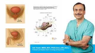 The Neural Hammock: Advancing Nerve-Sparing Robotic Prostatectomy at Mount Sinai