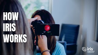 How IRIS Works