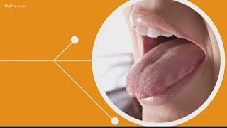 Here's the connection between a lack of sleep and an overweight tongue