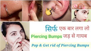 Piercing bumps गायब करने का आसान व घरेलू उपाय  How to pop & Get Rid of  Piercing bumps(keloid) Fast