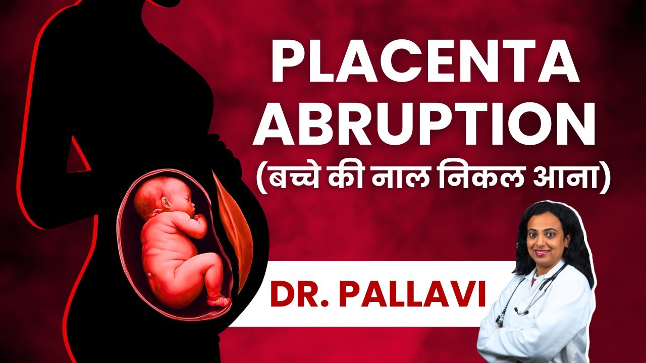 Placenta Abruption Causes, Symptoms, Diagnosis & Treatment - Explained ...