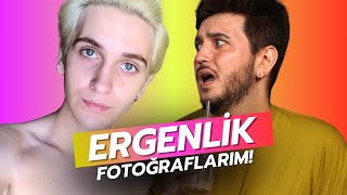 ERGENLİK FOTOĞRAFLARIMA BAKIYORUM!? (10.000 ÖZEL CRINGE KOMASI!)