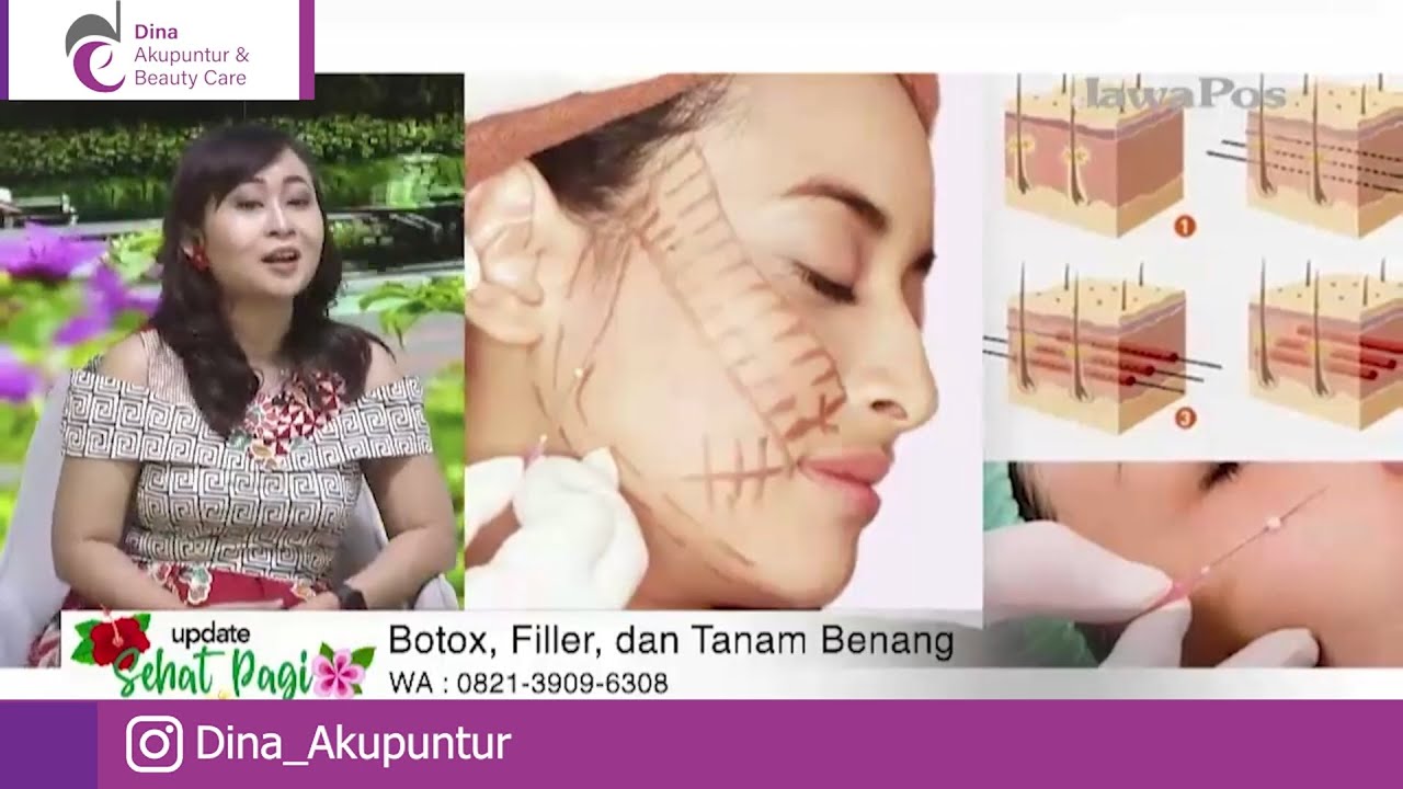 TALK SHOW Tentang BOTOX, FILLER Dan TANAM BENANG 🤗 {Part 2) - YouTube