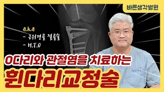 O다리와 퇴행성관절염을 치료하는 #근위경골절골술 #휜다리교정술! 내 무릎은 살려서 관절염을 치료한다?