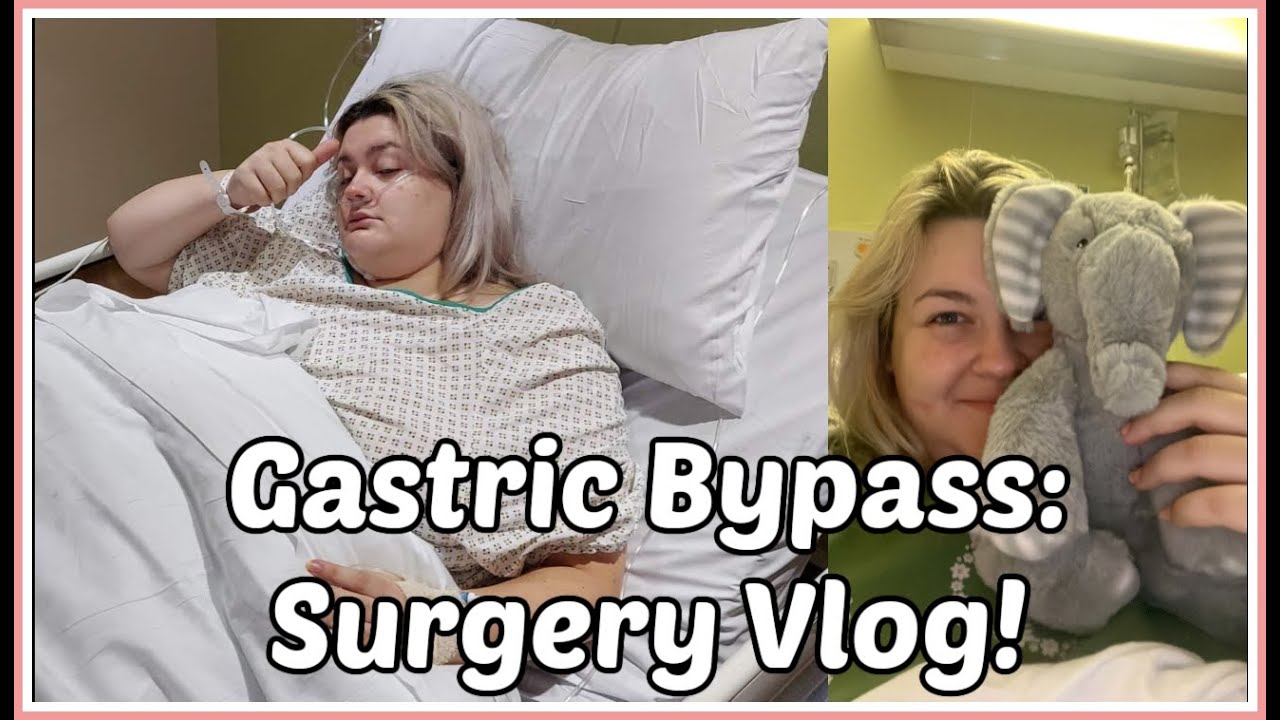 Face Breaking Out After Gastric Bypass At Ellis Brashears Blog