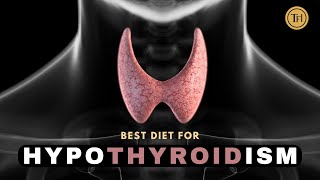 Easy Natural Treatment for Thyroid | Hypothyroidism Foods to Incorporate and Avoid