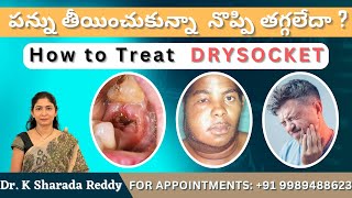 పన్ను తీయించుకున్నా నొప్పి తగ్గలేదా ? How to treat  DRYSOCKET|by Dr. Sharada Reddy in telugu