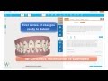 The Invisalign Clincheck Process from start to final approval video