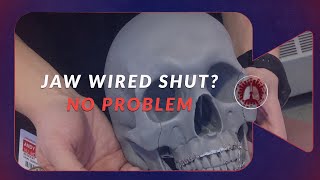 Jaw Wired Shut During an Airway Emergency. How to Fix it Even if You Don't Have