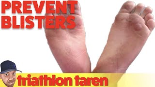 How to Avoid Blisters When Running