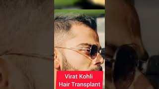 Virat Kohli Hair Transplant | Celebrity Hair Transplant | Indian Cricket Team #shorts