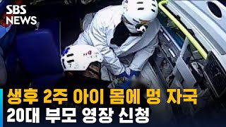 숨진 생후 2주 아이 몸에 멍 자국…부모 영장 신청 / SBS