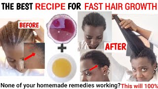 THE BEST RECIPE FOR FAST HAIR GROWTH|GROW YOUR HAIR FAST|NATURAL 4C HAIR|ONION JUICE FOR HAIR GROWTH