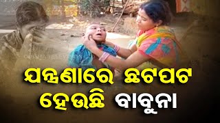 Apana Eka Nuhanty | Parents of minor divyang boy in Nayagarh cry for financial aid for treatment