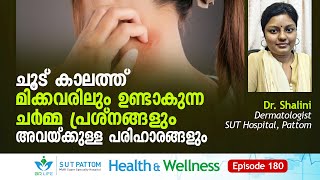 ചൂട്‌ കാലത്ത്‌ മിക്കവരിലും ഉണ്ടാകുന്ന ചർമ്മ പ്രശ്നങ്ങളും അവയ്ക്കുള്ള പരിഹാരങ്ങളും, SUT Ep #180