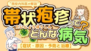 帯状疱疹ってどんな病気？【症状・原因・予防と治療】“ 現役内科医が解説 \