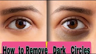 ඇස් යට කළු වෙලාද? How To Remove Dark Circles Naturally | Home Remedies For Dark Circles | #Short