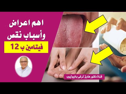 12 مؤشراً على نقص فيتامين B12 فى جسمك | نقص فيتامين ب 12 الاعراض والاسباب 12 مؤشراً على نقص فيتامين B12 فى جسمك | نقص فيتامين ب 12 الاعراض والاسباب