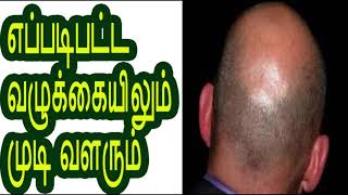 எப்படிபட்ட வழுக்கையிலும் முடி வளரும்  Hair grows in any kind of  bald head