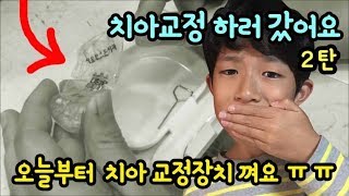 치아교정 하러 치과에 갔어요 ㅠㅠ 2부 (오늘부터 당장 치아 교정장치 끼래요 ㅠㅠ) 치아교정 상담 과정 생생 밀착 중계 마이린 일상 브이로그 | 마이린TV