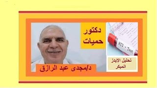 تحليل الإيدز المبكر | early HIV test