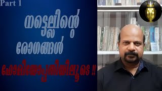 നടുവേദന | നട്ടെല്ലിൻറെ രോഗങ്ങൾ ഹോമിയോപ്പതിയിലൂടെ | Back pain | Dr. Jackson D'silva | Part 1