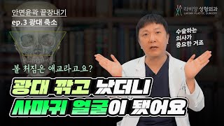 [안면윤곽끝장내기] 제 3강. 광대축소수술 방식에 따른 차이와 효과