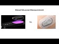 Know Labs vs. Dexcom