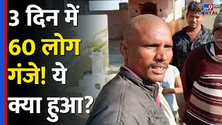 Maharashtra के इस गांव में गंजे क्यों हो रहे हैं लोग, इस बीमारी से Doctor भी हैरान #tv9d