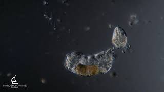 Rotifer laying an egg, 200x DIC